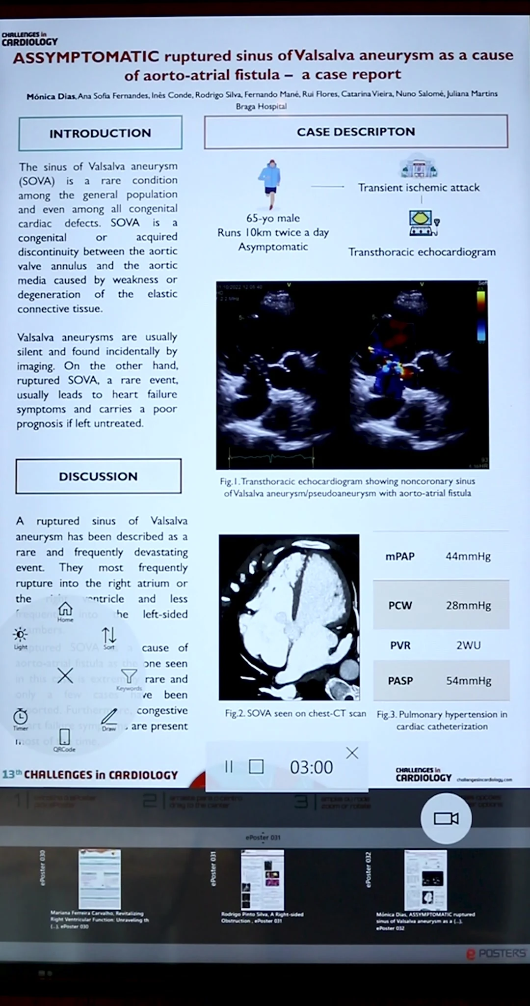 ePosters platform with circular menu, scientific poster and presentation timer